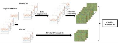 Graph Empirical Mode Decomposition-Based Data Augmentation Applied to Gifted Children MRI Analysis